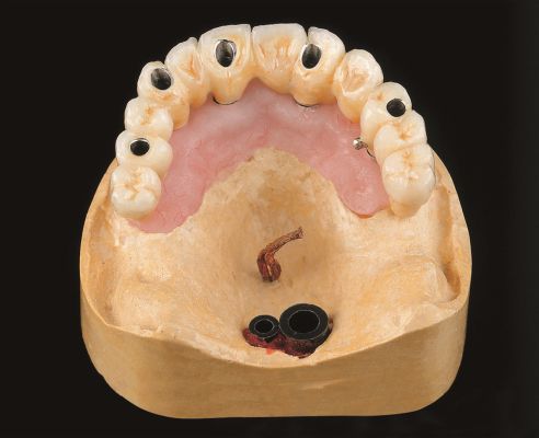 SAE Funkenerosion von WDT