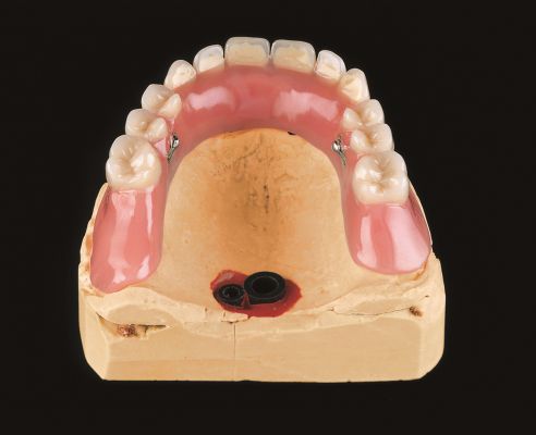 SAE Funkenerosion von WDT