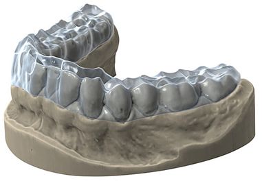 Knirscherschienen gegen Bruxismus als Therapieschiene