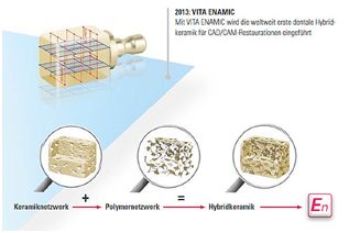 Veneers aus Hybridkeramik