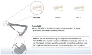 Veneers aus Hybridkeramik