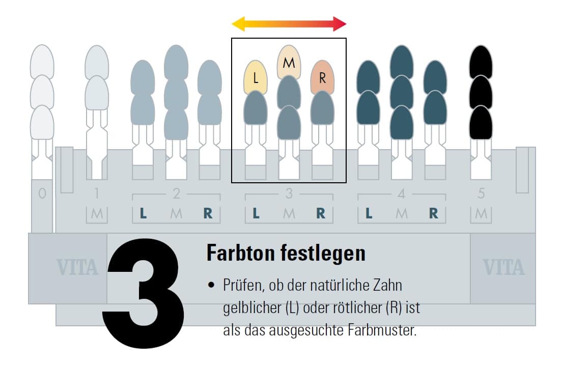 Zahnfarbbestimmung Vita 3D-Master