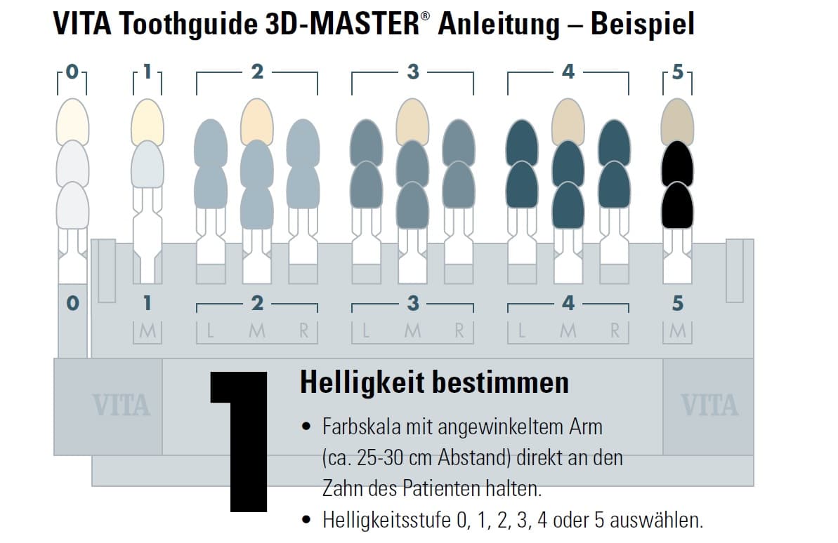 Zahnfarbbestimmung Vita 3D-Master