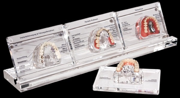 Schaumodelle-Zahnersatz für Zahnarztpraxen bei der Patientenberatung