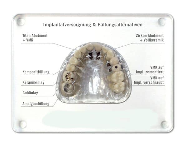 Schaumodelle-Zahnersatz für Zahnarztpraxen bei der Patientenberatung