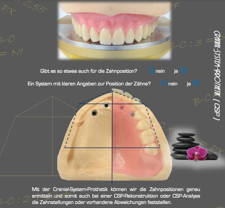 Ganzheitlicher Zahnersatz